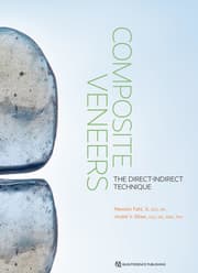 Cover von Composite Veneers