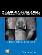 Cover von Musculoskeletal X-Rays for Medical Students and Trainees