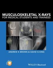 Cover von Musculoskeletal X-Rays for Medical Students and Trainees