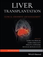 Cover von Liver Transplantation