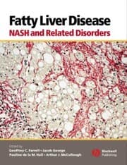 Cover von Fatty Liver Disease