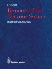 Cover von Tumours of the Nervous System