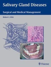 Cover von Salivary Gland Diseases