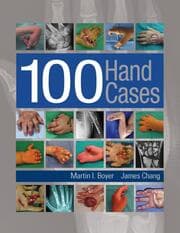 Cover von 100 Hand Cases
