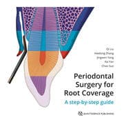 Cover von Periodontal Surgery for Root Coverage