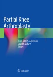 Cover von Partial Knee Arthroplasty