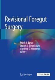 Cover von Revisional Foregut Surgery