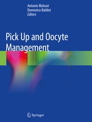 Cover von Pick Up and Oocyte Management