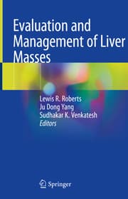 Cover von Evaluation and Management of Liver Masses