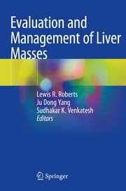 Cover von Evaluation and Management of Liver Masses