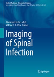 Cover von Imaging of Spinal Infection