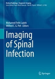 Cover von Imaging of Spinal Infection