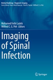 Cover von Imaging of Spinal Infection