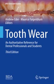 Cover von Tooth Wear