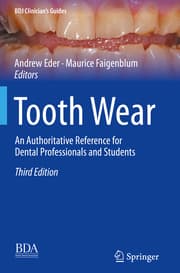 Cover von Tooth Wear