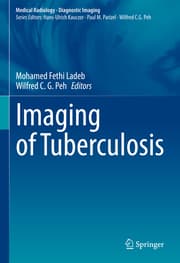 Cover von Imaging of Tuberculosis