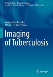 Cover von Imaging of Tuberculosis