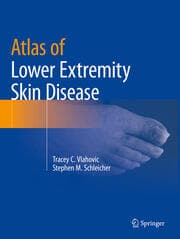 Cover von Atlas of Lower Extremity Skin Disease