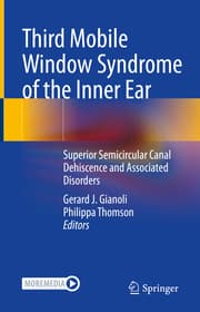 Cover von Third Mobile Window Syndrome of the Inner Ear