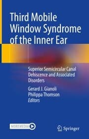 Cover von Third Mobile Window Syndrome of the Inner Ear