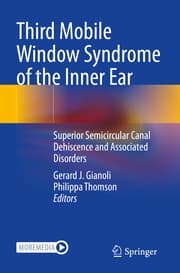 Cover von Third Mobile Window Syndrome of the Inner Ear