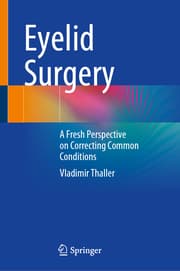 Cover von Eyelid Surgery