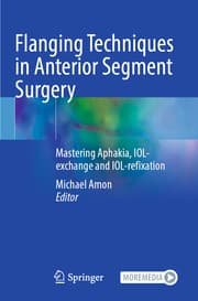 Cover von Flanging Techniques in Anterior Segment Surgery