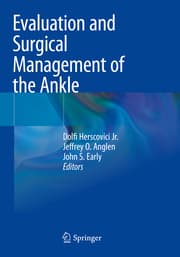 Cover von Evaluation and Surgical Management of the Ankle