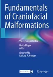 Cover von Fundamentals of Craniofacial Malformations