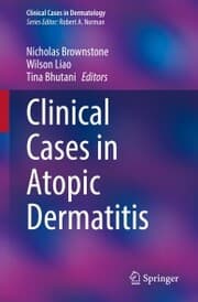 Cover von Clinical Cases in Atopic Dermatitis