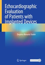 Cover von Echocardiographic Evaluation of Patients with Implanted Devices
