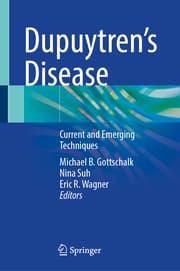 Cover von Dupuytren's Disease