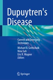 Cover von Dupuytren's Disease