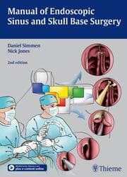 Cover von Manual of Endoscopic Sinus Surgery