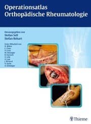 Cover von Operationsatlas Orthopädische Rheumatologie