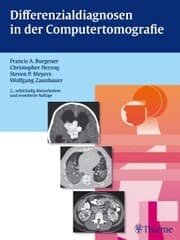 Cover von Differenzialdiagnosen in der Computertomografie