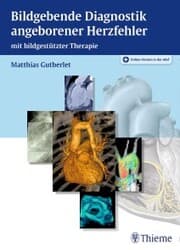 Cover von Bildgebende Diagnostik angeborener Herzfehler