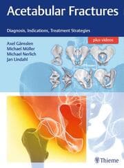 Cover von Acetabular Fractures