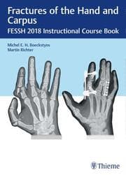Cover von Fractures of the Hand and Carpus
