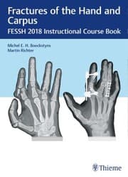 Cover von Fractures of the Hand and Carpus