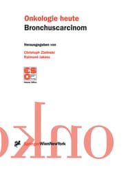 Cover von Bronchuscarcinom