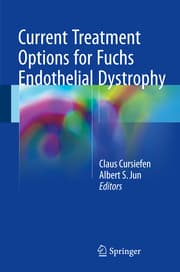 Cover von Current Treatment Options for Fuchs Endothelial Dystrophy