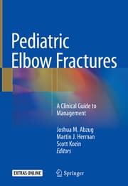 Cover von Pediatric Elbow Fractures