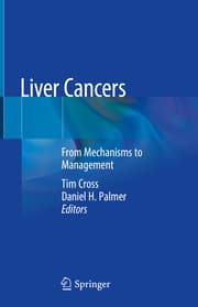 Cover von Liver Cancers