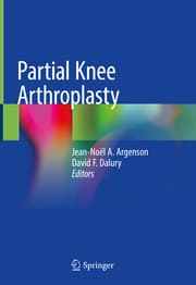 Cover von Partial Knee Arthroplasty