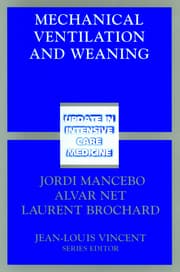 Cover von Mechanical Ventilation and Weaning