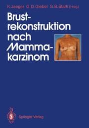 Cover von Brustrekonstruktion nach Mammakarzinom