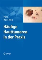 Cover von Häufige Hauttumoren in der Praxis