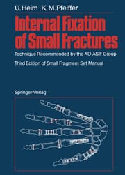 Cover von Internal Fixation of Small Fractures