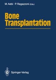 Cover von Bone Transplantation